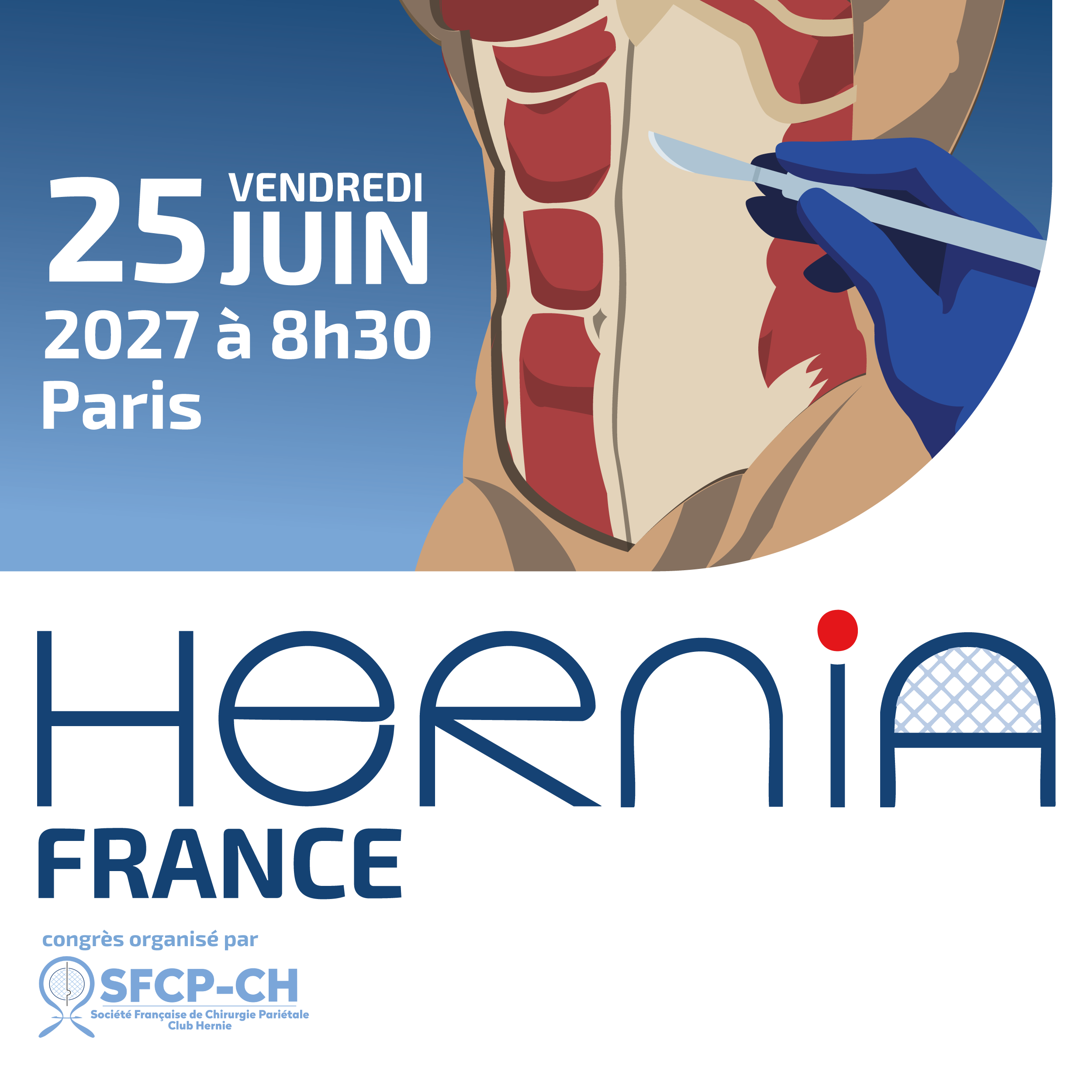 HERNIA-